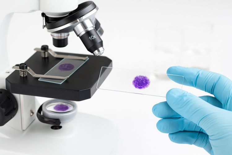 Сбор секрета простаты