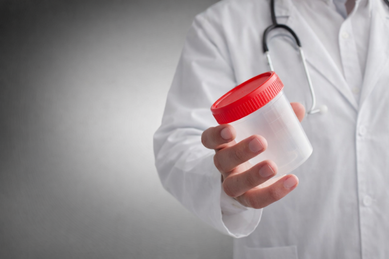 Кровь в моче: от безобидных причин до сигналов, которые нельзя игнорировать