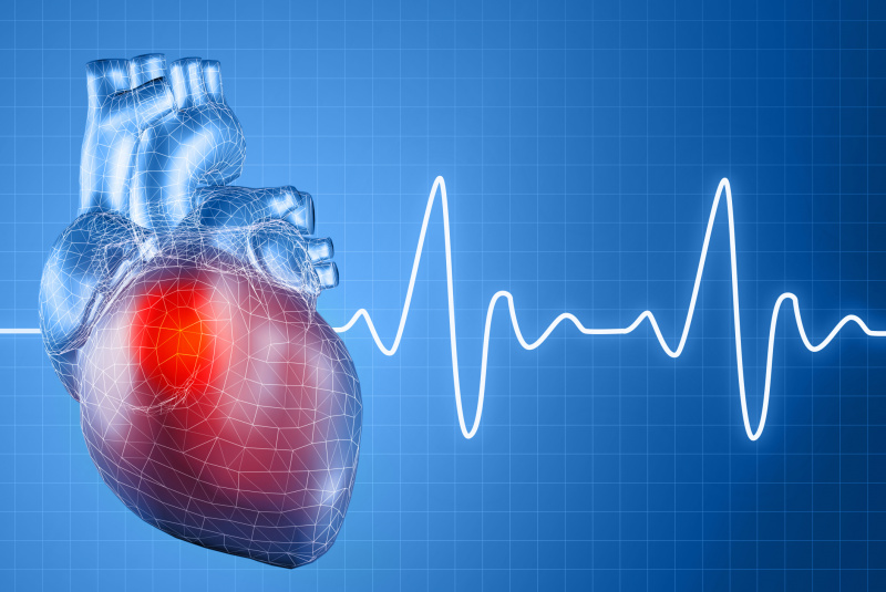 Сердечная аритмия: причины, виды, лечение