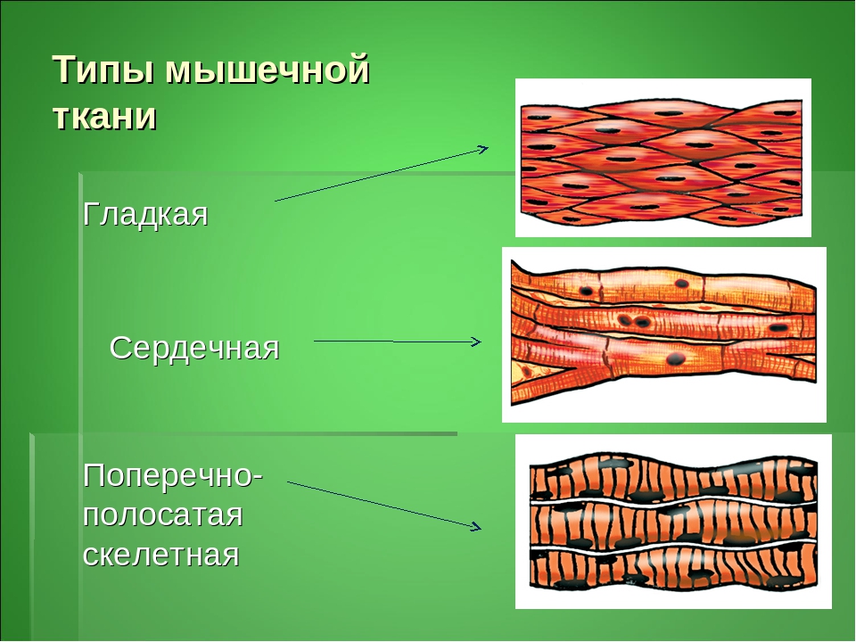 Скелетная поперечно полосатая мускулатура состоит из. Поперечнополосатая сердечная мышечная ткань. Поперечно полосатая Скелетная сердечная ткань. Поперечнополосатая сердечная мышца ткани. Поперечнополосатая Скелетная мышечная ткань строение.