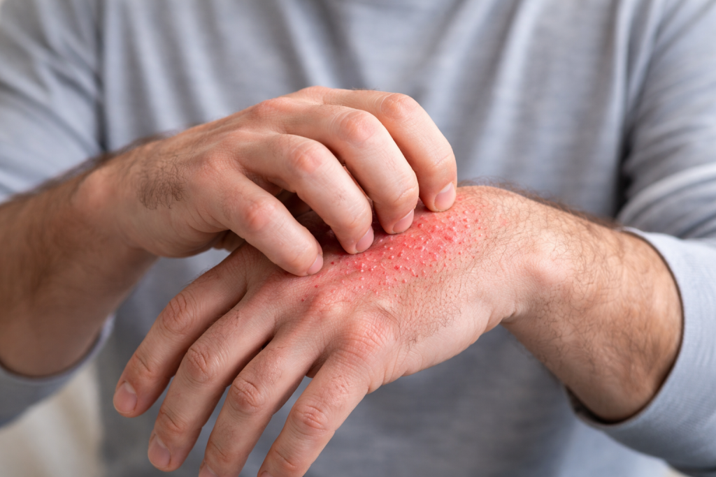 зуд чесотка руки боль в руках сыпь.png